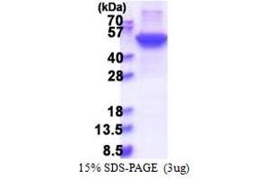 SDS-PAGE (SDS) image for Keratin 17 (KRT17) (AA 1-432) protein (His tag) (ABIN5853572) (KRT17 Protein (AA 1-432) (His tag))