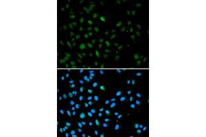 Immunofluorescence analysis of A549 cells using EZH1 antibody (ABIN5973432). (EZH1 anticorps)