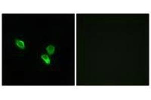 Immunofluorescence analysis of MCF-7 cells, using MRPS18C antibody.