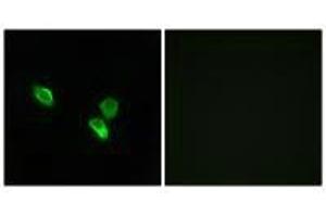 Immunofluorescence analysis of MCF-7 cells, using MRPS18C antibody. (MRPS18C anticorps)