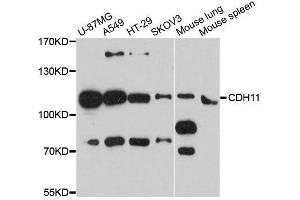 Western blot analysis of extracts of various cell lines, using CDH11 antibody. (OB Cadherin anticorps  (AA 637-796))
