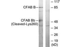 Western Blotting (WB) image for anti-Complement Factor B (CFB) (AA 241-290), (Cleaved-Lys260) antibody (ABIN2891191) (Complement Factor B anticorps  (Cleaved-Lys260))