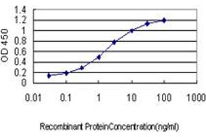 Detection limit for recombinant GST tagged CRYM is approximately 0. (CRYM anticorps  (AA 215-314))