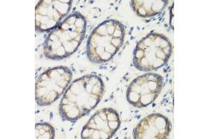 Immunohistochemistry of paraffin-embedded human colon using TGM5 antibody.