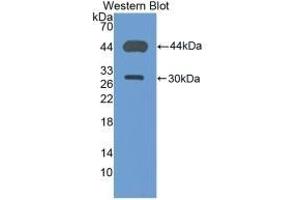 Detection of Recombinant CD4, Mouse using Polyclonal Antibody to Cluster Of Differentiation 4 (CD4)