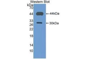 Detection of Recombinant CD4, Mouse using Polyclonal Antibody to Cluster Of Differentiation 4 (CD4) (CD4 anticorps  (AA 27-394))
