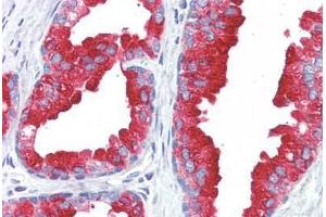 Human Prostate (formalin-fixed, paraffin-embedded) stained with ACPP antibody ABIN364499 at 5 ug/ml followed by biotinylated anti-mouse IgG secondary antibody ABIN481714, alkaline phosphatase-streptavidin and chromogen. (ACPP anticorps)