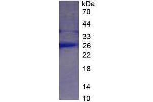 SDS-PAGE of Protein Standard from the Kit (Highly purified E. (CRP Kit ELISA)