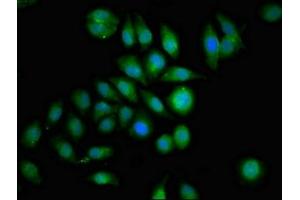 Immunofluorescence staining of A549 cells with ABIN7154498 at 1:100, counter-stained with DAPI. (GRB14 anticorps  (AA 294-397))