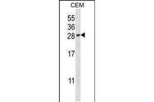 Western blot analysis in CEM cell line lysates (35ug/lane). (PLGF anticorps  (AA 120-148))
