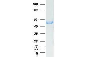 Validation with Western Blot