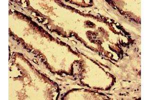 Immunohistochemistry analysis of human prostate tissue using ABIN7148523 at dilution of 1:100 (Copine IV anticorps  (AA 1-280))