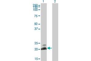Western Blot analysis of HAND2 expression in transfected 293T cell line by HAND2 monoclonal antibody (M10), clone 3F10. (HAND2 anticorps  (AA 135-216))
