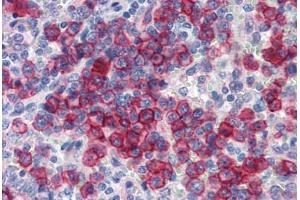 Human Spleen (formalin-fixed, paraffin-embedded) stained with NCOA3 antibody ABIN462179 followed by biotinylated goat anti-rabbit IgG secondary antibody ABIN481713, alkaline phosphatase-streptavidin and chromogen.