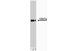 Western blot analysis of Tyrosine Hydroxylase on rat cerebrum lysate. (Tyrosine Hydroxylase anticorps  (AA 18-133))