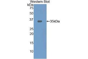 Western blot analysis of recombinant Rat LOX1. (OLR1 anticorps  (AA 51-314))