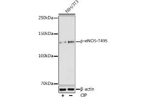 Western blot analysis of extracts of NIH/3T3 cells, using Phospho-eNOS-T495 antibody (ABIN6135215, ABIN6136066, ABIN6136067 and ABIN6225549) at 1:1000 dilution. (ENOS anticorps  (pThr495))