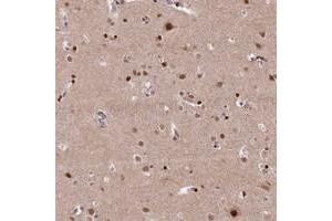 Immunohistochemical staining of human cerebral cortex with MCF2L2 polyclonal antibody  shows strong nuclear positivity in neuronal cells at 1:20-1:50 dilution. (MCF2L2 anticorps)