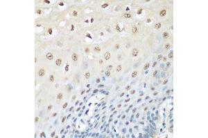 Immunohistochemistry of paraffin-embedded human esophagus using VCP antibody.