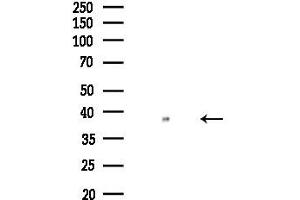 Western blot analysis of lysates from COLO205 cells, using ZIP2 Antibody at 1/1000 dilution.