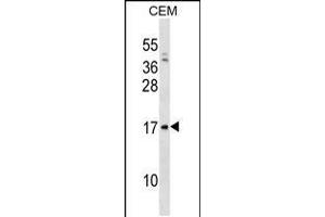 Western blot analysis in CEM cell line lysates (35ug/lane). (VPREB1 anticorps  (AA 71-99))