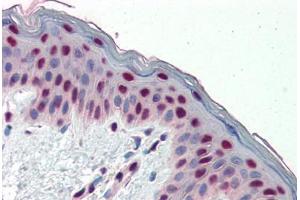 Human Skin (formalin-fixed, paraffin-embedded) stained with FOSL1 antibody ABIN462165 followed by biotinylated goat anti-rabbit IgG secondary antibody ABIN481713, alkaline phosphatase-streptavidin and chromogen.