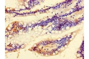 Immunohistochemistry of paraffin-embedded human small intestine tissue using ABIN7174920 at dilution of 1:100 (C9ORF57 anticorps  (AA 51-127))