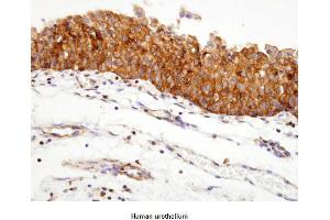 Immunohistochemistry (IHC) image for anti-Heat Shock Protein 90kDa alpha (Cytosolic), Class A Member 1 (HSP90AA1) (AA 1-732), (N-Term) antibody (ABIN317532) (HSP90AA1 anticorps  (N-Term))