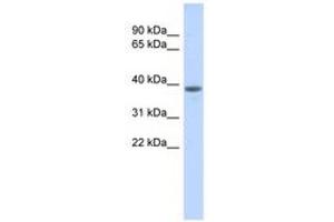 Image no. 1 for anti-DDB1 and CUL4 Associated Factor 4-Like 1 (DCAF4L1) (AA 323-372) antibody (ABIN6741260) (DCAF4L1 anticorps  (AA 323-372))