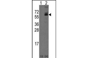 Western blot analysis of Noelin-1(Olfm1) (arrow) using rabbit polyclonal Noelin-1(Olfm1) Antibody (C-term) (ABIN389178 and ABIN2839341). (Olfactomedin 1 anticorps  (C-Term))