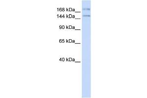 WB Suggested Anti-IFT140 Antibody Titration:  0. (IFT140 anticorps  (N-Term))