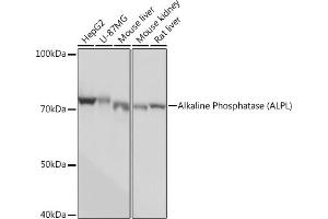 Western blot analysis of extracts of various cell lines, using Alkaline Phosphatase (ALPL) (ALPL) Rabbit mAb (ABIN7265551) at 1:1000 dilution.