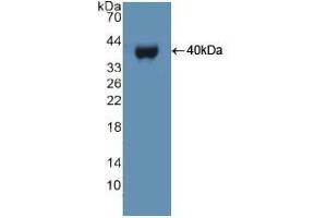 Detection of Recombinant UBE3A, Human using Polyclonal Antibody to Ubiquitin Protein Ligase E3A (UBE3A) (ube3a anticorps  (AA 158-407))