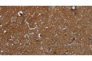 Immunohistochemistry of paraffin-embedded Human brain using GALT Polyclonal Antibody at dilution of 1:30 (GALT anticorps)