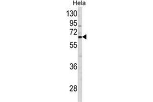 Western blot analysis of CTPS2 Antibody (N-term) in Hela cell line lysates (35ug/lane). (CTPS2 anticorps  (N-Term))