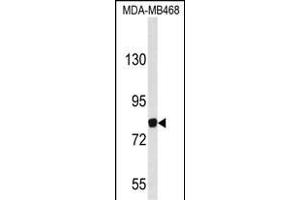 Western blot analysis of EVI5 Antibody (N-term) (ABIN653115 and ABIN2842698) in MDA-M cell line lysates (35 μg/lane).