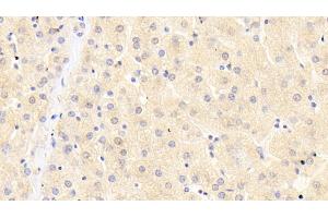 Detection of CDO1 in Human Liver Tissue using Polyclonal Antibody to Cysteine Dioxygenase I (CDO1)