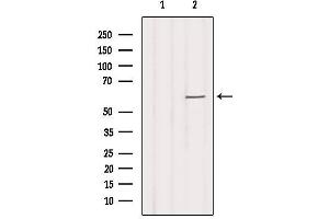 Western blot analysis of extracts from Hela, using SLC16A2 Antibody. (SLC16A2/MCT8 anticorps  (Internal Region))