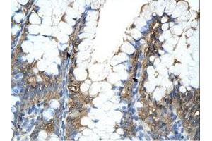 Image no. 1 for anti-Peptidylprolyl Isomerase A (Cyclophilin A) (PPIA) (C-Term) antibody (ABIN321858)