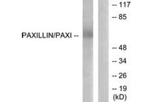 Western blot analysis of extracts from HeLa cells, using Paxillin (Ab-118) Antibody. (Paxillin anticorps  (AA 85-134))