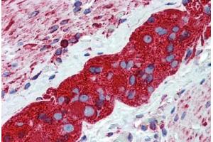 Human Small Intestine, Myenteric Plexus: Formalin-Fixed, Paraffin-Embedded (FFPE) (TUBB2A anticorps  (AA 1-446))