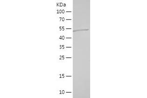 Western Blotting (WB) image for Optineurin (OPTN) (AA 16-223) protein (His-IF2DI Tag) (ABIN7124266)