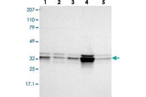 Western blot analysis of lane 1: RT-4, lane 2: EFO-21, lane 3: A-431, lane 4: Liver and lane 5: Tonsil using MPST polyclonal antibody .