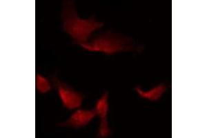 ABIN6269368 staining HepG2 by IF/ICC.