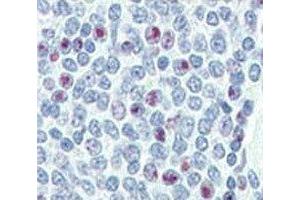 IHC analysis of FFPE human spleen tissue stained with NANOG antibody