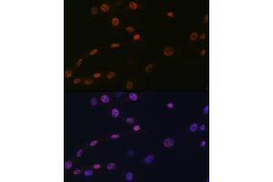 Immunofluorescence analysis of NIH-3T3 cells using K/H Rabbit mAb (ABIN7267702) at dilution of 1:100 (40x lens). (HAT1 anticorps)