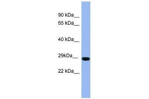 RAB1A antibody used at 1 ug/ml to detect target protein. (RAB1A anticorps  (Middle Region))