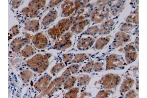 Detection of COL4a3 in Human Stomach Tissue using Polyclonal Antibody to Collagen Type IV Alpha 3 (COL4a3)