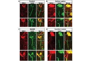 Representative cortical layer 5/6 pyramidal neurons from control, (B) active MS lesion, (C) NAGM, (D) inactive MS lesion tissues immunolabelled with anti-SMI32, and their AIS immunolabelled with anti-AnkG. (Ankyrin G anticorps)