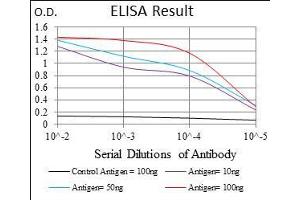 Black line: Control Antigen (100 ng), Purple line: Antigen(10 ng), Blue line: Antigen (50 ng), Red line: Antigen (100 ng),
